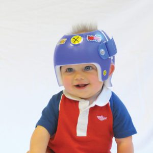 Ortho Design - little boy in a blue helmet - older