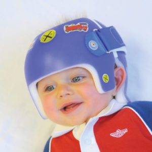 Ortho Design - little boy in a blue helmet