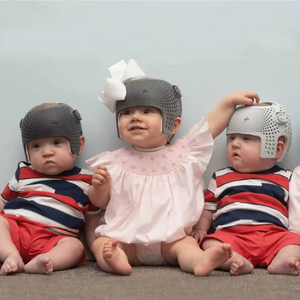 Cranial Remolding Orthoses (CRO) | Baby Helmets STARband 3D printed helmet